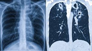 Inçekeseli anyklamak